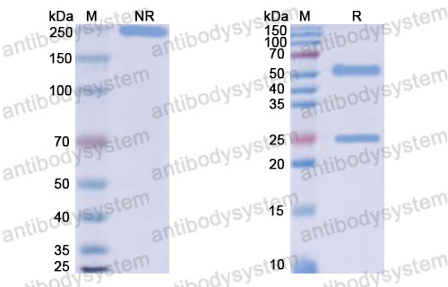Валидация SDS-PAGE - AntibodySystem DHK27201