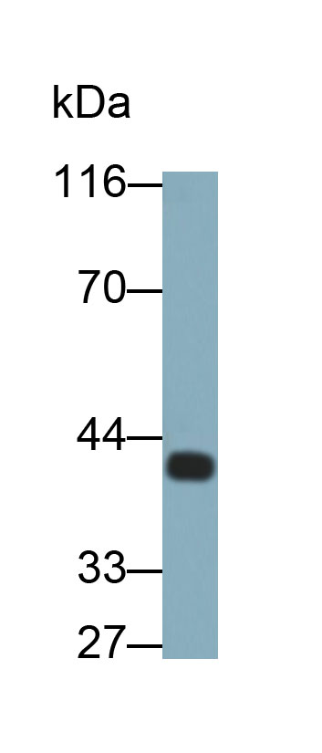 28398