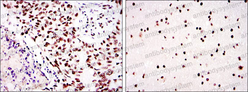 Валидация AntibodySystem RHF68702