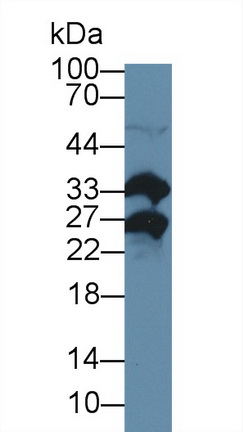 12695