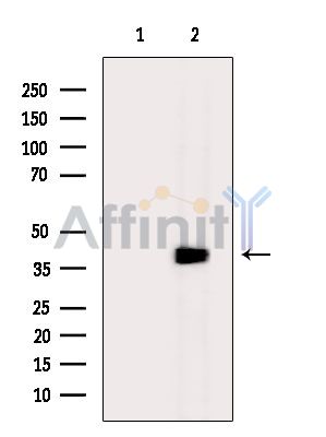 Валидация Affinity DF14425 - 10371