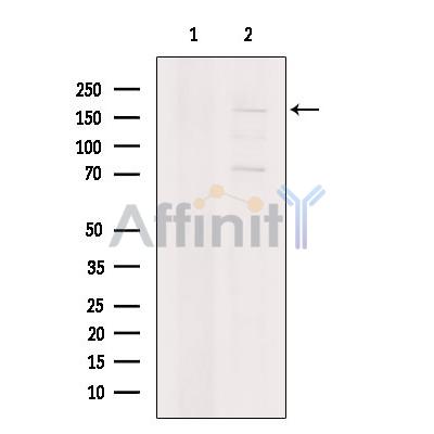 Валидация Affinity DF3611 - 14580
