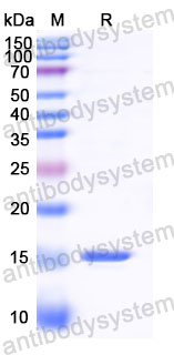 Валидация SDS-PAGE - AntibodySystem RWK25803