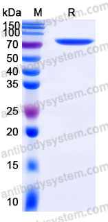 EHJ61603, SDS-PAGE
