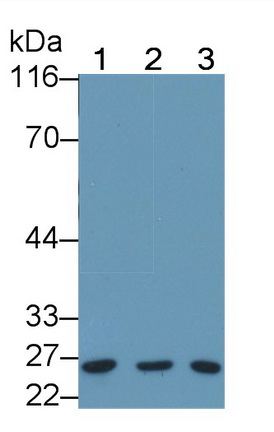 22871