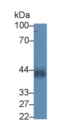 13868