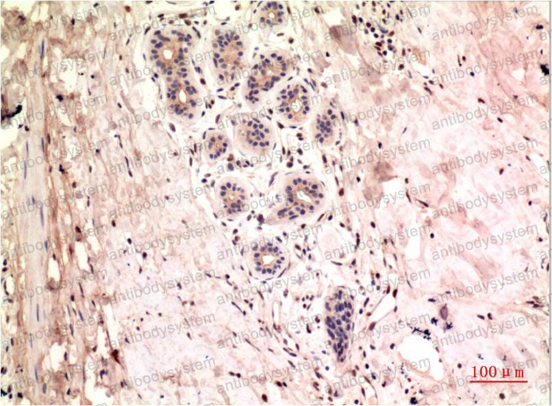 Валидация AntibodySystem RHD56203