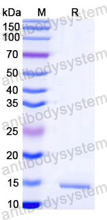 Валидация SDS-PAGE - AntibodySystem RVV00805