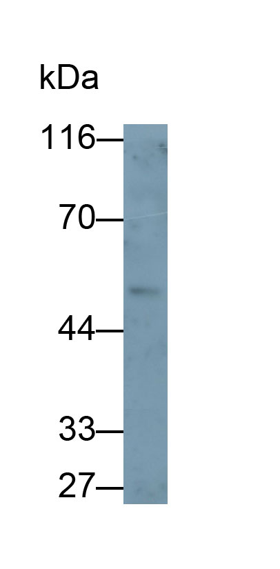 5585