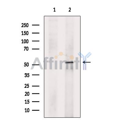Валидация Affinity DF13740 - 9387