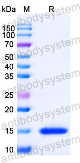 Валидация SDS-PAGE - AntibodySystem RHC81001