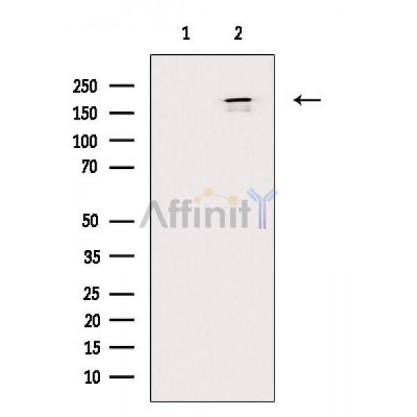 Валидация Affinity DF8813 - 20866