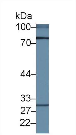 14418