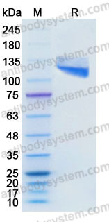 EHD33103, SDS-PAGE