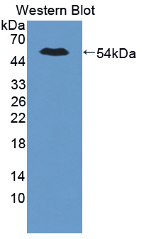 57179