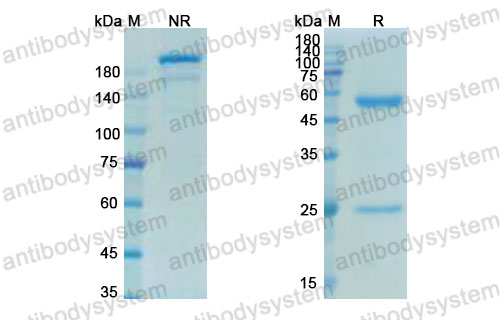 Валидация SDS-PAGE - AntibodySystem DHE43206