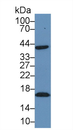 14707