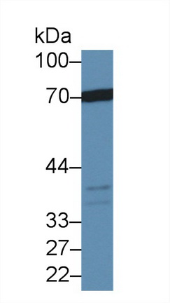12630