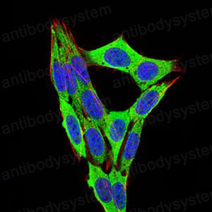 Валидация IF - AntibodySystem RHC19910
