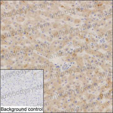 Валидация AntibodySystem RHE85802 (2374)