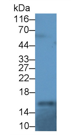 14748
