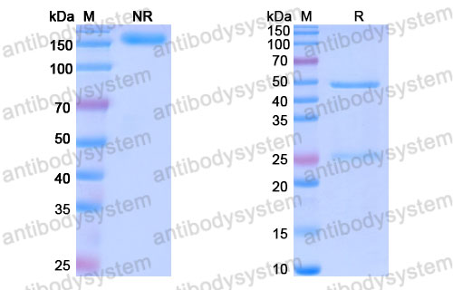 Валидация SDS-PAGE - AntibodySystem FHJ92830