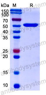 Валидация SDS-PAGE - AntibodySystem DHD37506