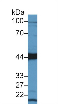 14439