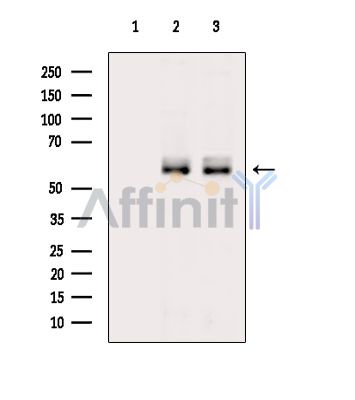 Валидация Affinity DF15418 - 11746