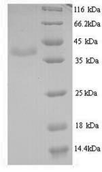 SDS-PAGE