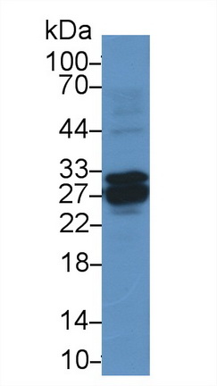 14613