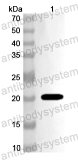 Валидация AntibodySystem PHA76301