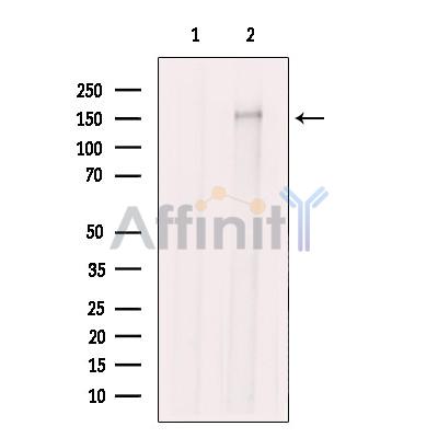 Валидация Affinity AF4621 - 2233