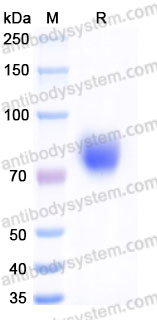 AHD47902, SDS-PAGE