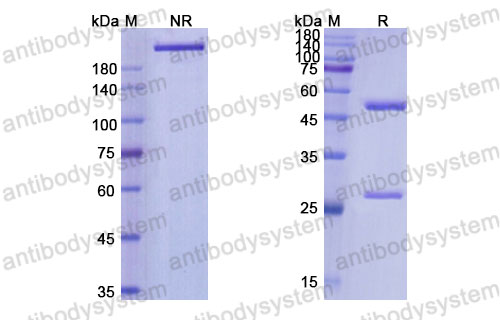 Валидация SDS-PAGE - AntibodySystem DHD17206