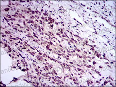 Валидация AntibodySystem RHF85302 (2703)