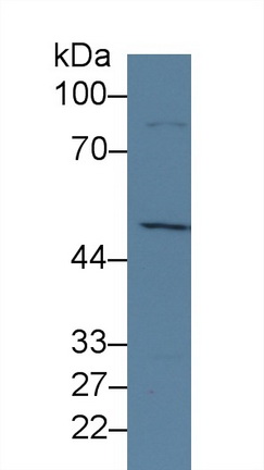 14214