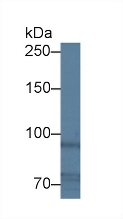 12794