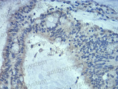 Валидация AntibodySystem RHD39303 (1558)