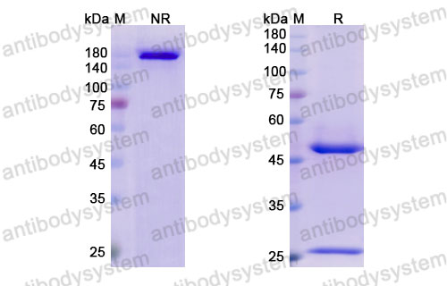 Валидация SDS-PAGE - AntibodySystem DHJ28403