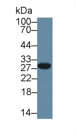 14104
