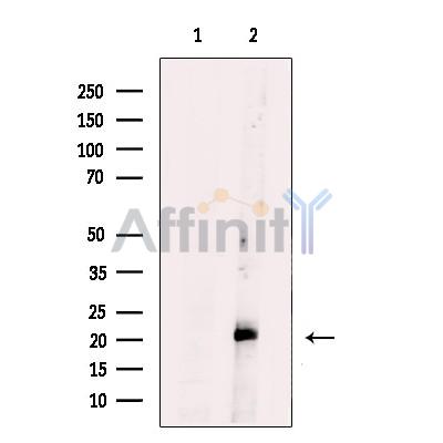 Валидация Affinity DF12052 - 6104
