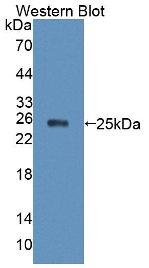 41529