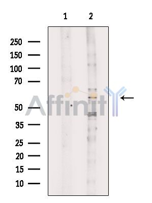 Валидация Affinity DF3955 - 15161