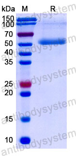 Валидация SDS-PAGE - AntibodySystem DHC80029