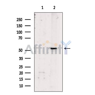 Валидация Affinity DF9468 - 22056