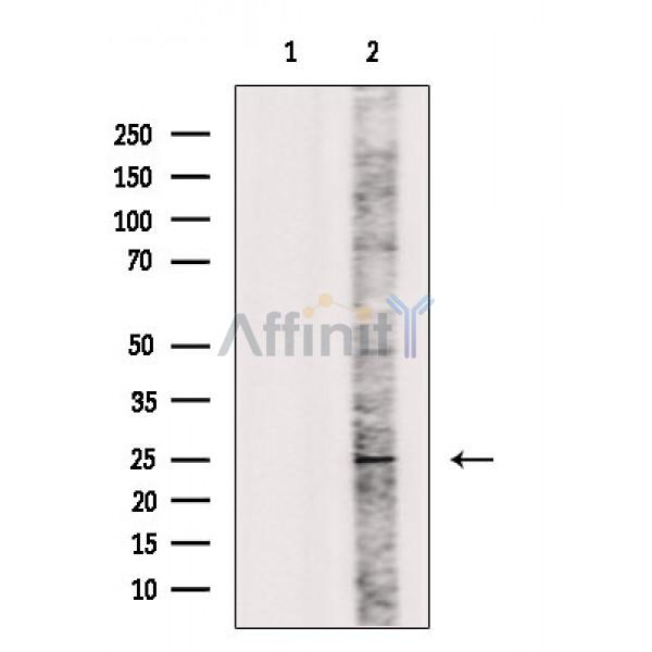 Валидация Affinity DF2524 - 13180