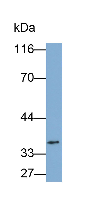 31817