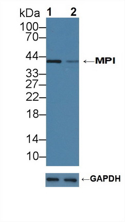 12235