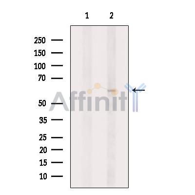 Валидация Affinity DF9298 - 21756